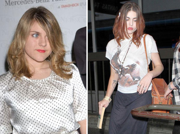 Frances Bean Cobain Plastic Surgery Before & After Frances Bean Cobain Plastic Surgery Before & After