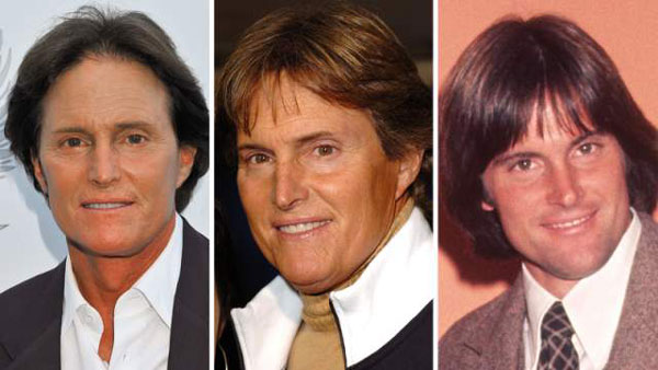 Worst Plastic Surgery Bruce Jenner Before & After Worst Plastic Surgery Bruce Jenner