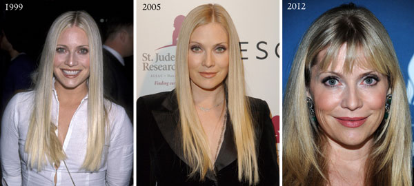 Emily Procter Before & After Plastic Surgery Emily Procter Before & After Plastic Surgery