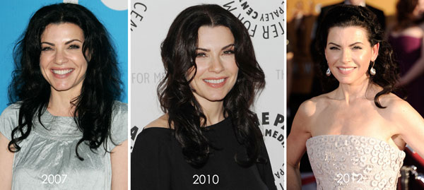 Julianna Margulies Plastic Surgery Before & After Julianna Margulies Plastic Surgery Before & After