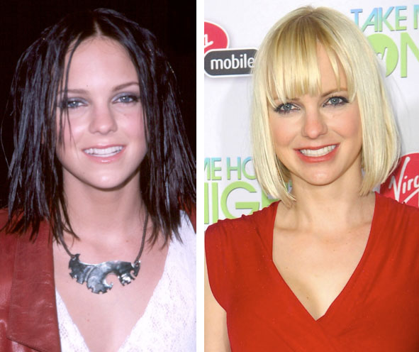 Anna Faris Nose Job Before & After Anna Faris Nose Job Before & After
