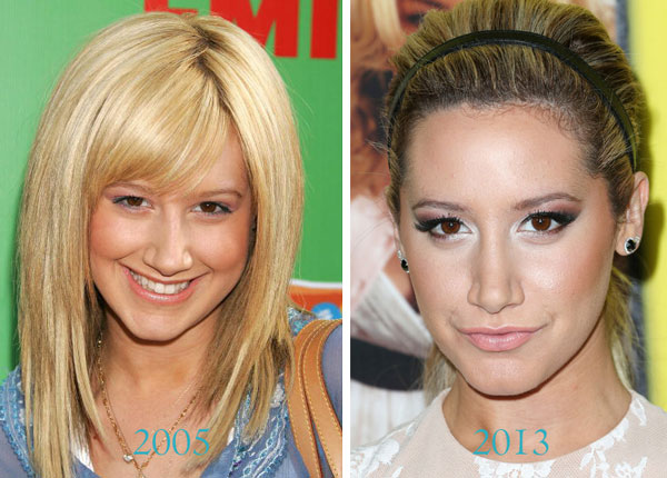 Ashley Tisdale Nose Job Photo Ashley Tisdale Nose Job Photo