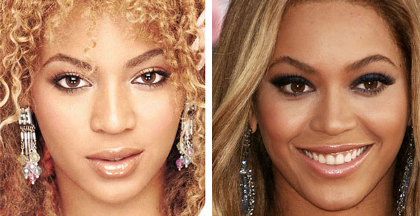 Beyonce Nose Job Before & After Beyonce Nose Job Before & After