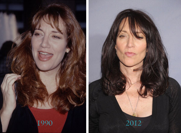 Katey Sagal Before & After Plastic Surgery Katey Sagal Before & After Plastic Surgery
