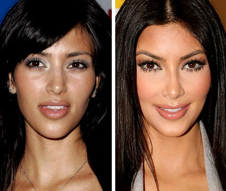 Kim Kardashian Nose Job Kim Kardashian Nose Job