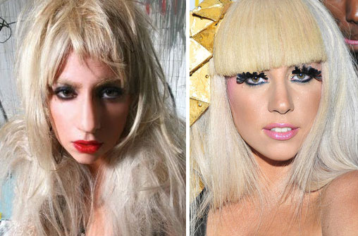 Lady Gaga Nose Job Photo Lady Gaga Nose Job Photo