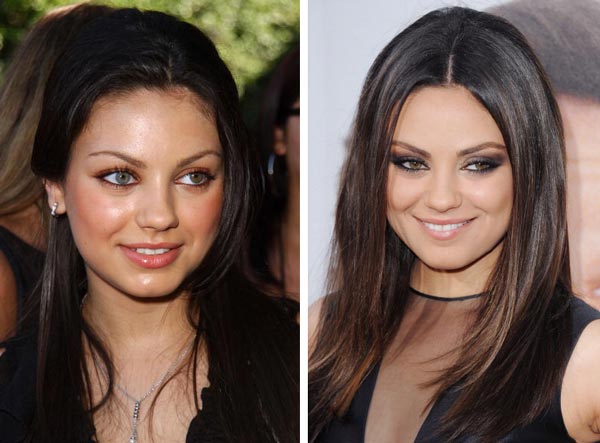 Mila Kunis Nose Job Before & After Mila Kunis Nose Job Before & After