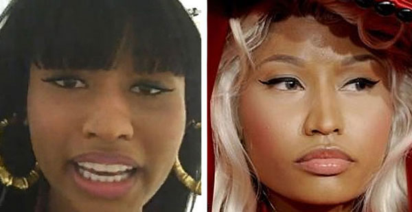Nicki Minaj Nose Job Before & After Nicki Minaj Nose Job Before & After