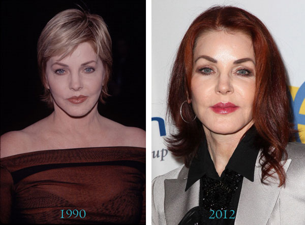 Priscilla Presley Before & After Plastic Surgery Priscilla Presley Before & After Plastic Surgery