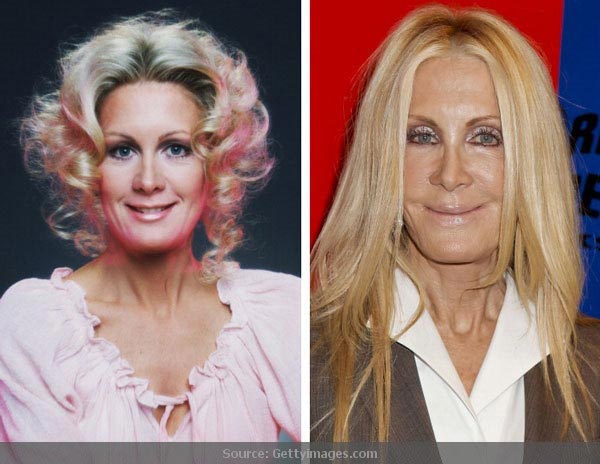 Joan Van Ark Before After Plastic Surgery Joan Van Ark Before After Plastic Surgery