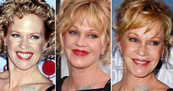 Melanie Griffith Before After Plastic Surgery Melanie Griffith Before After Plastic Surgery