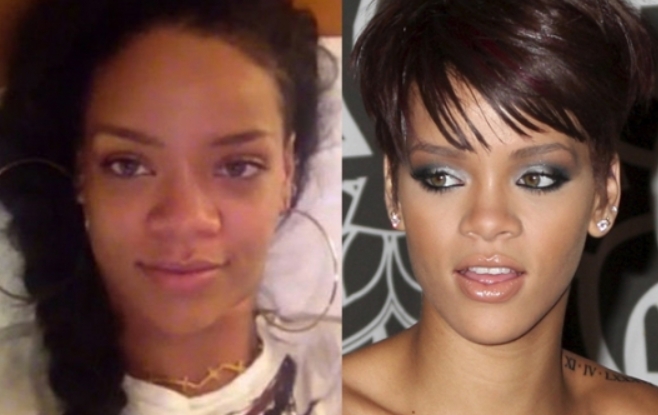 Rihanna Plastic Surgery Before and After