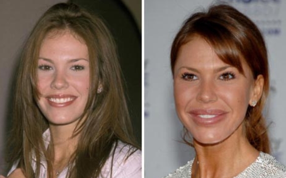 Nikki Cox Plastic Surgery Before and After