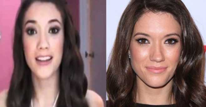 Blair Fowler Plastic Surgery Before and After