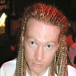 Axl Rose Plastic Surgery