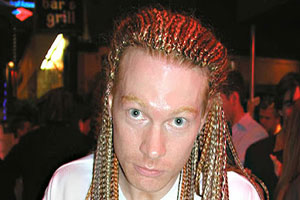 Axl Rose Plastic Surgery