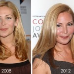 Jennifer Westfeldt Plastic Surgery Before & After