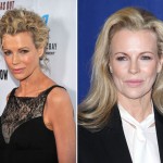 Kim Basinger Plastic Surgery Before & After