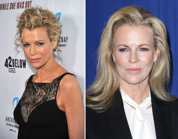 Kim Basinger Plastic Surgery Before & After