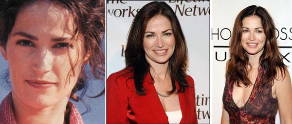 Kim Delaney Before & After Plastic Surgery
