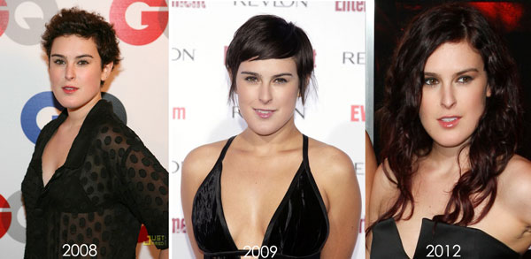 Rumer Willis Plastic Surgery