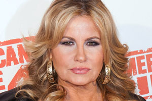 Jennifer Coolidge Plastic Surgery