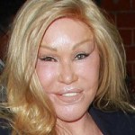 Jocelyn Wildenstein “Cat Woman” Plastic Surgery
