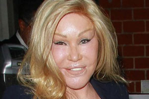Jocelyn Wildenstein “Cat Woman” Plastic Surgery