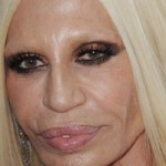 Donatella Versace Plastic Surgery