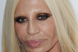 Donatella Versace Plastic Surgery