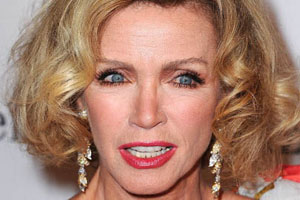 Donna Mills Plastic Surgery