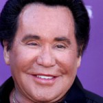 Wayne Newton Plastic Surgery