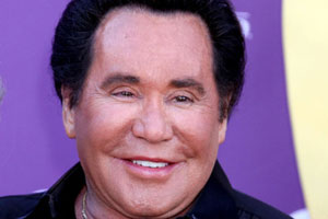 Wayne Newton Plastic Surgery