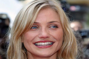 Cameron Diaz Plastic Surgery