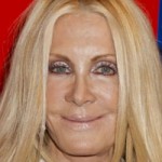 Joan Van Ark Plastic Surgery