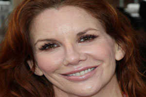 Melissa Gilbert Plastic Surgery