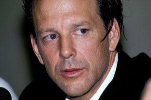 Mickey Rourke Plastic Surgery
