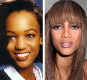 Tyra Banks Nose Job