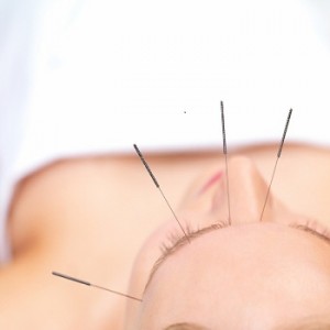 Acupuncture as Alternative Treatment