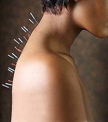 Neural Acupressure as Alternative Treatment