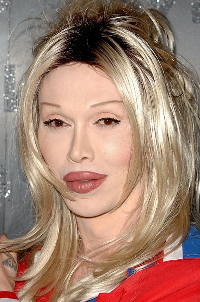 Pete Burns Disastrous Plastic Surgeries